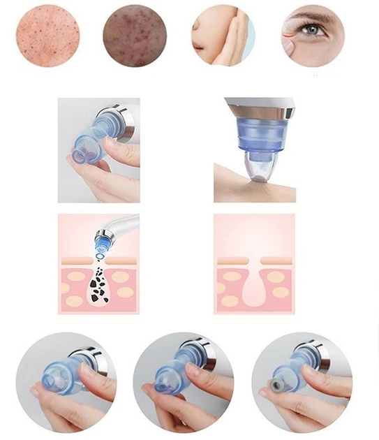 Вакуумний апарат для чищення пор Derma Suction White (100)